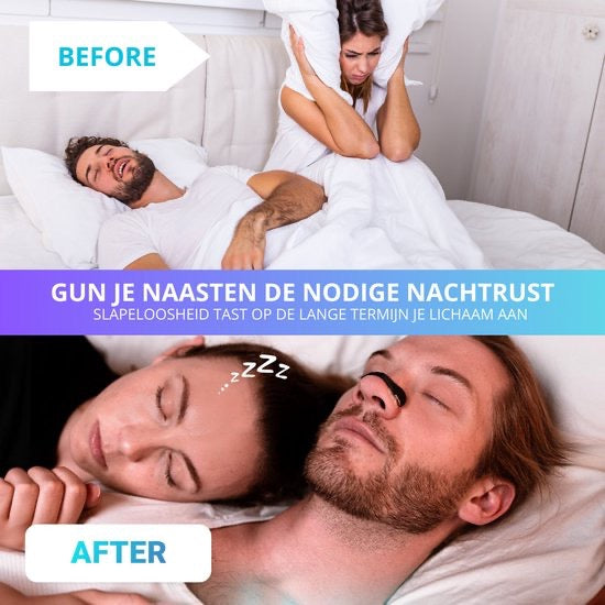 NOSSON® Magnetische Neusstrips (starter-pack) 15 st.